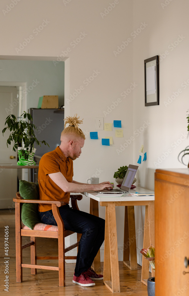 Albino african american man with dreadlocks working from home and using laptop Albino african american man with dreadlocks working from home and using laptop
