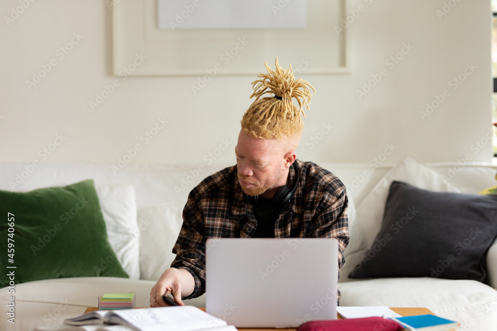 Albino african american man with dreadlocks working from home and using laptop Albino african american man with dreadlocks working from home and using laptop