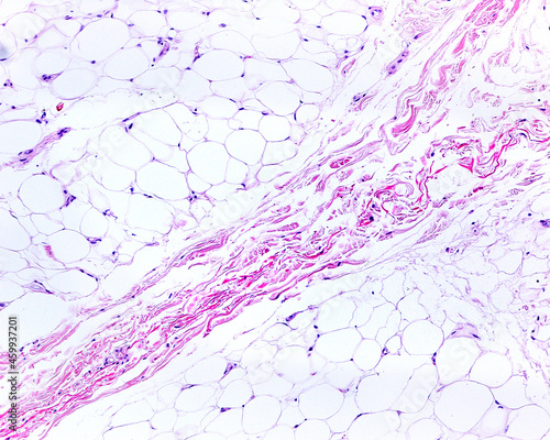 Subcutaneous adipose tissue. Blood vessels