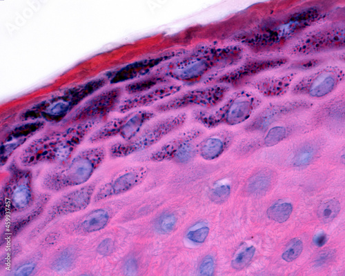 Epidermis. Granular and cornified layers photo
