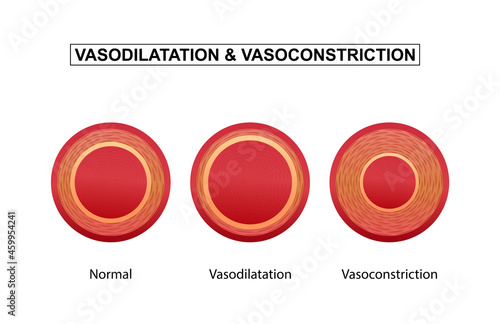 Vasodilation and vasoconstriction. comparison of Blood vessels. photo