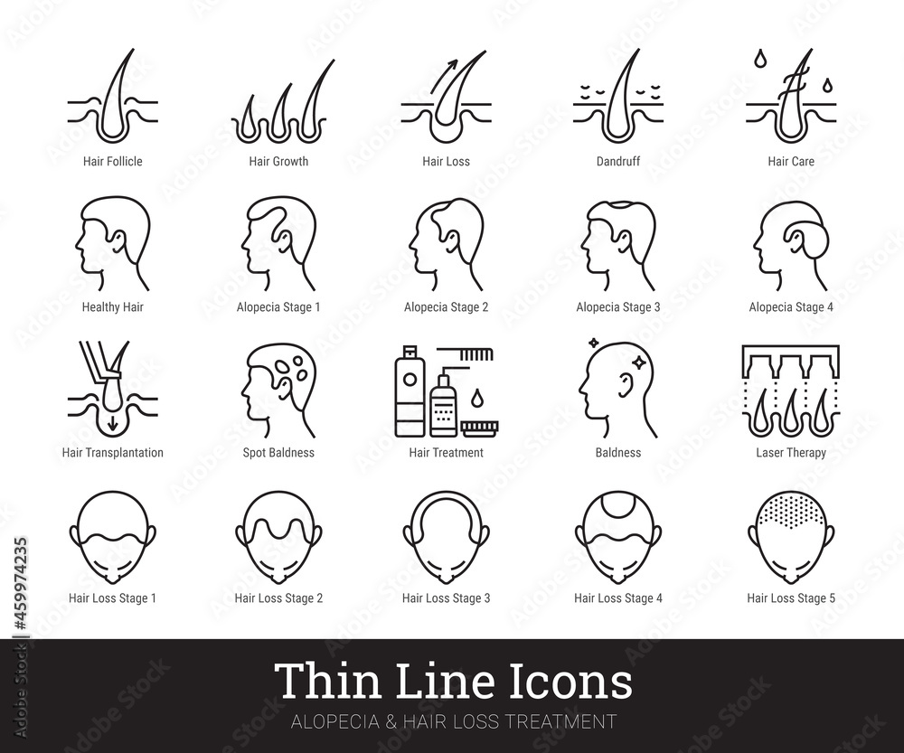 Alopecia, hair loss treatment thin line icons. Vector linear pictograms related to hair health care, loss problem, baldness, laser therapy. Icon set isolated on white background. Editable strokes.