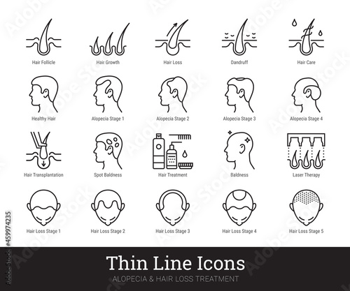 Alopecia, hair loss treatment thin line icons. Vector linear pictograms related to hair health care, loss problem, baldness, laser therapy. Icon set isolated on white background. Editable strokes.