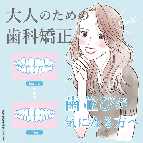 歯科矯正のイラスト