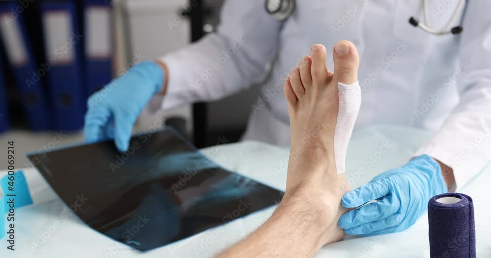 Doctor traumatologist looking at xray of foot in front of patient sore leg 4k movie Doctor traumatologist looking at xray of foot in front of patient sore leg 4k movie