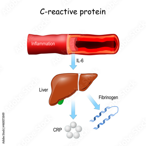 C-reactive protein CRP photo