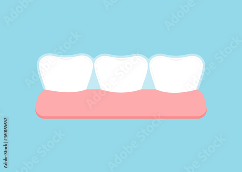 Invisible braces bracket on tooth in gum. Dental invisalign braces on white tooth orthodontic correction treatment concept. Vector flat design tooth dentistry clip art illustration.
