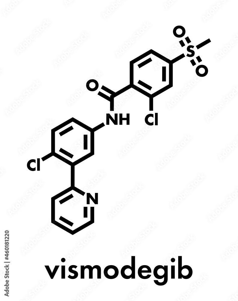 Vismodegib cancer drug molecule. Used in treatment of basal cell carcinoma. Skeletal formula. Vismodegib cancer drug molecule. Used in treatment of basal cell carcinoma. Skeletal formula.