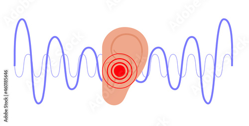 Tinnitus disease concept