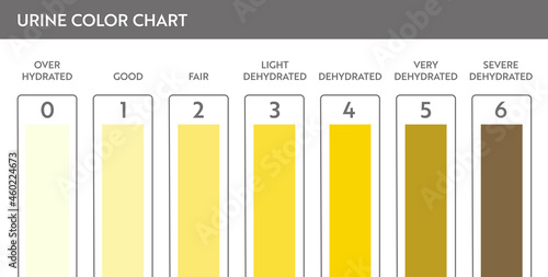 Urine color chart. Pee hydration and dehydration test strip. Vector design for medical education poster.