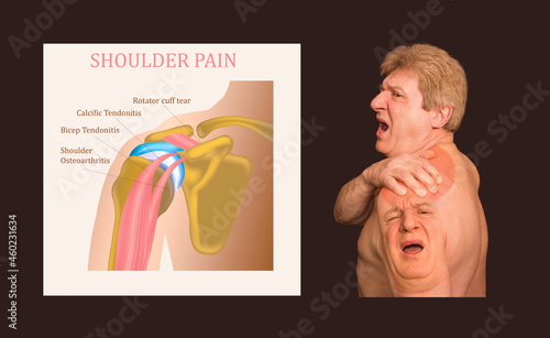 Shoulder joint structure labeled. photo