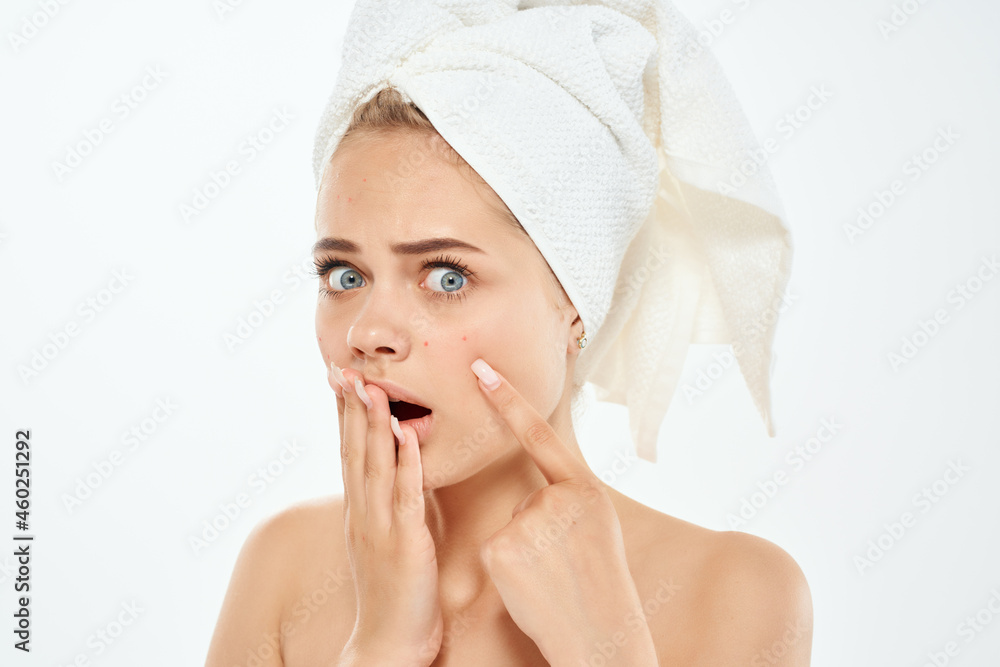 woman with a towel on my head acne on the face hygiene woman with a towel on my head acne on the face hygiene