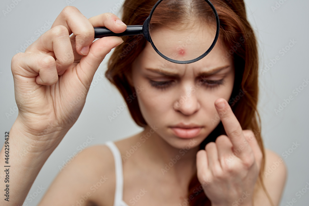 pretty woman with a pimple on the face cosmetology Studio pretty woman with a pimple on the face cosmetology Studio