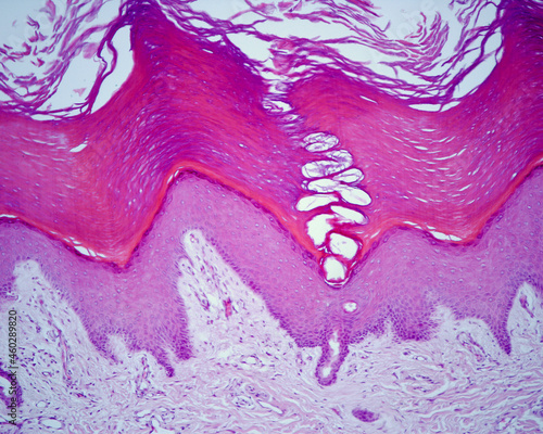 Photos Thick skin. Strata of the epidermis