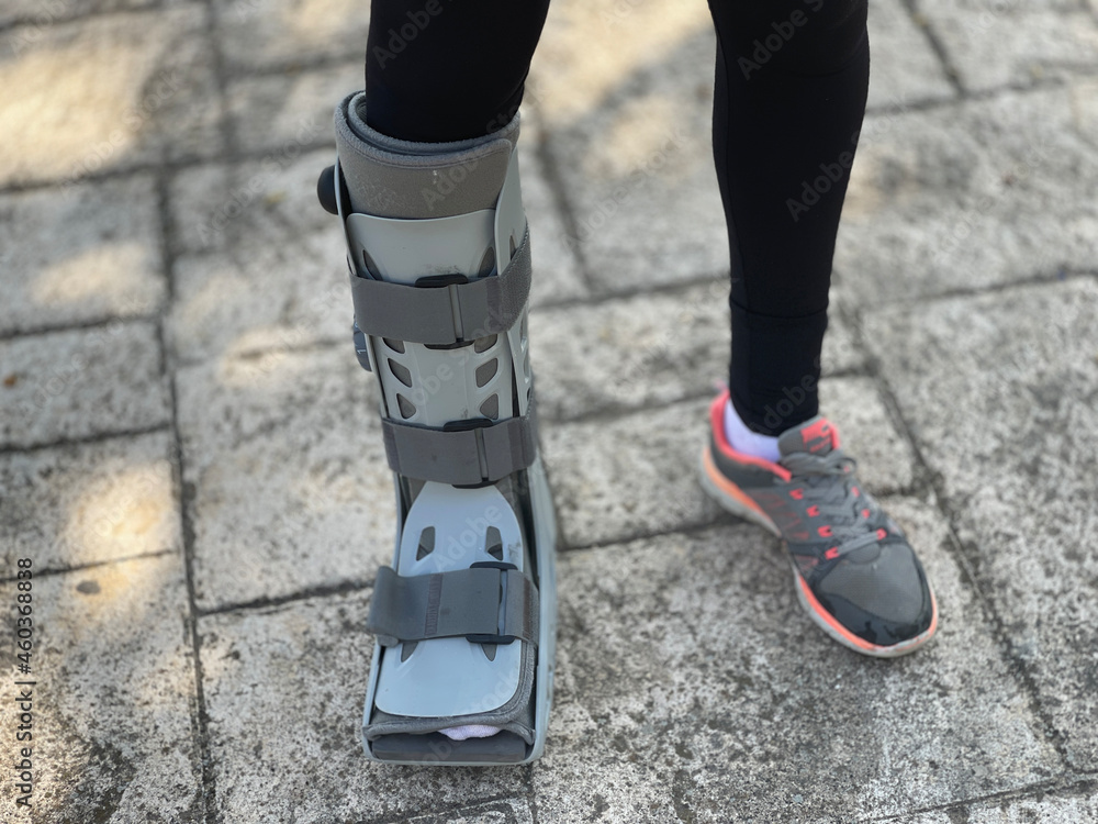Photograph of orthopedic boot ideal for walking women with leg injuries such as fractured tibia or fibula. Patient walking down the street.