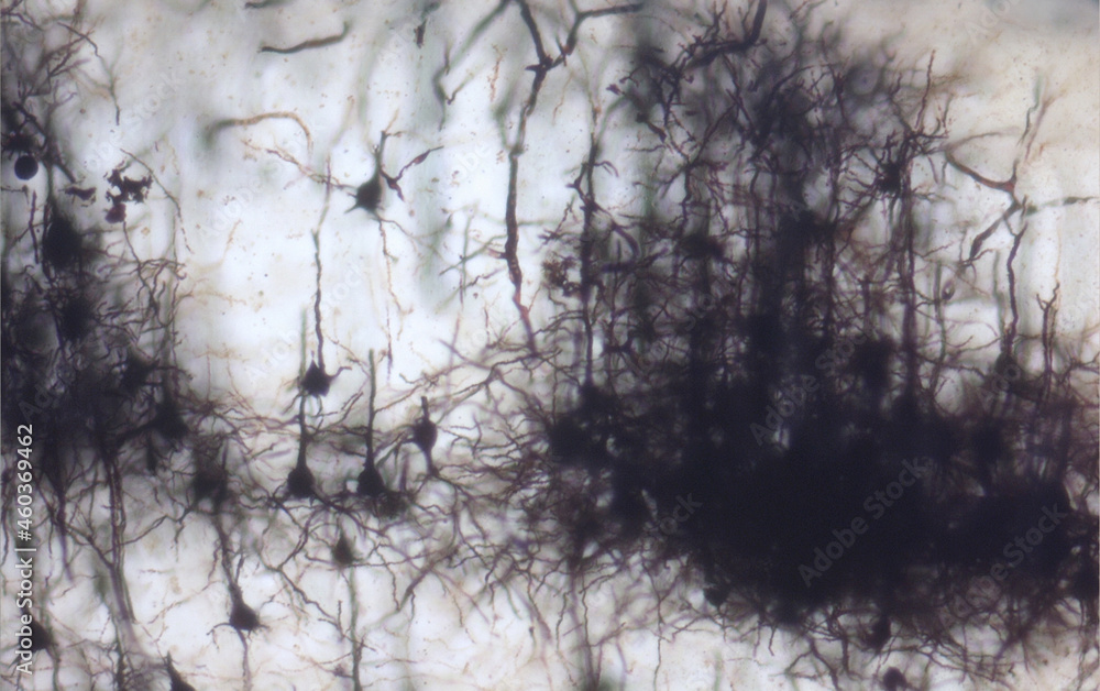 Mouse brain section stained with the Golgi stain, a 19th century technique that was widely used until recently - and occasionally still is. Widefield microscopy. Neurons in the cerebral cortex. Mouse brain section stained with the Golgi stain, a 19th century technique that was widely used until recently - and occasionally still is. Widefield microscopy. Neurons in the cerebral cortex.