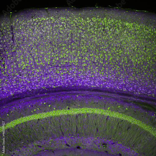 Fotografie Cerebral cortex and part of the hippocampus under it in a section of a mouse bra