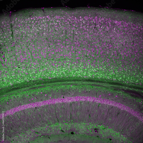 фотографія Cerebral cortex and part of the hippocampus under it in a section of a mouse bra