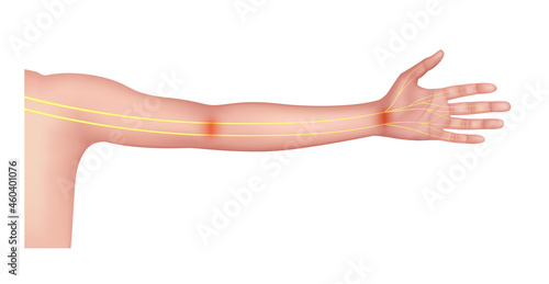 Nerve of the arm about human anatomy yellow. On a white background. Medical and scientific concepts. 3D vector EPS10.
