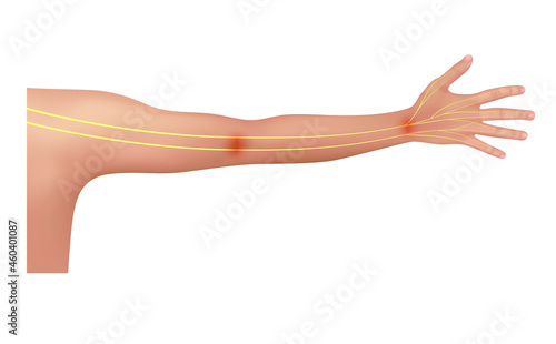 Nerve of the arm about human anatomy yellow. On a white background. Medical and scientific concepts. 3D vector EPS10.