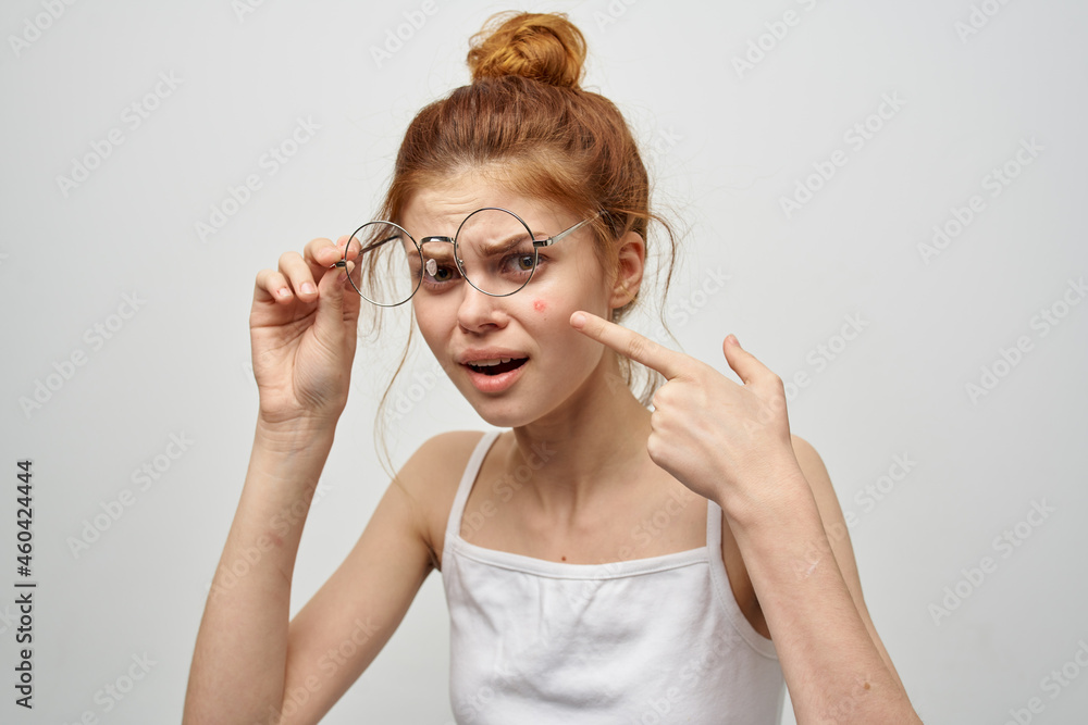woman face with pimple skin problems close-up woman face with pimple skin problems close-up
