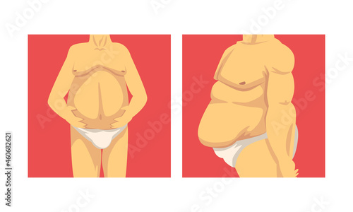 Male Torso with Sagging Belly and Soft Muscles Vector Set