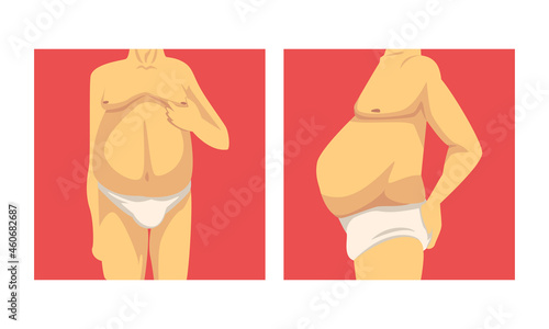 Male Torso with Sagging Belly and Soft Muscles Vector Set