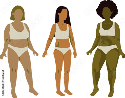 Vector. Cuerpos diversos, belleza natural, mujeres vistiendo ropa interior. 