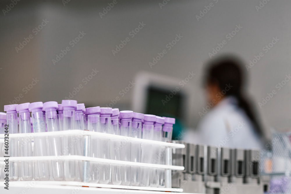 Tubos de ensayo laboratorio clinico foto de Stock | Adobe Stock