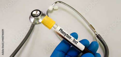 Fotografi Blood sample tube for Barbiturate and Phenytoin test at medical laboratory
