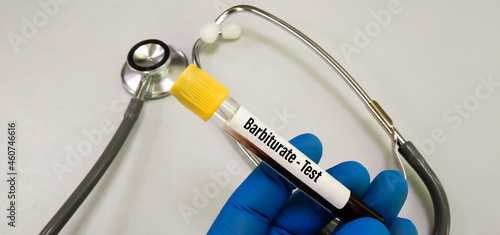 Blood sample tube for Barbiturate and Phenytoin test at medical laboratory. To diagnosis doping, drugs barbiturate presence in human blood sample. photo
