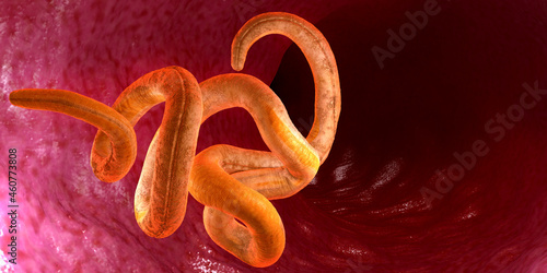 Single twisted nematode inside intestine on a black background - 3d illustration photo