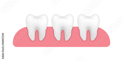 Vector image of white clear teeth. Realistic healthy tooth with glowing effect, teeth whitening. Dental health concept. Concept whitening, care dental. Vector Illustration