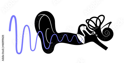 Tinnitus disease concept