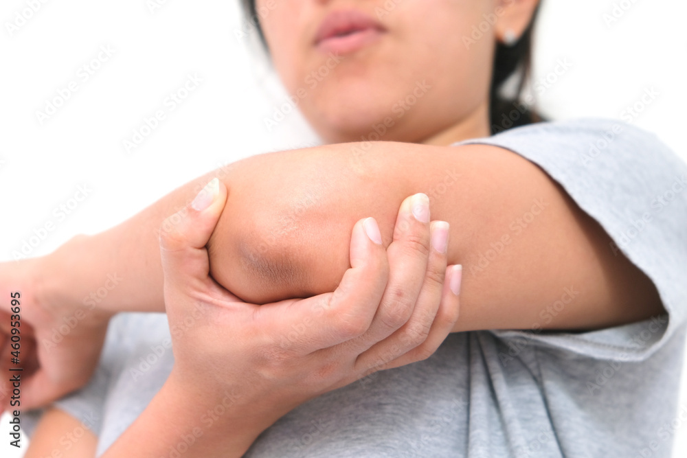 woman use their hands to hold their elbows and she had pain at the elbows.. Painful Health and medical concepts woman use their hands to hold their elbows and she had pain at the elbows.. Painful Health and medical concepts