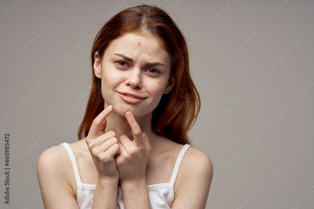 red-haired woman facial skin problems dermatology isolated background red-haired woman facial skin problems dermatology isolated background