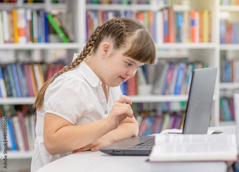 Girl with Downs syndrome uses a laptop at school. Education for disabled children concept Girl with Downs syndrome uses a laptop at school. Education for disabled children concept