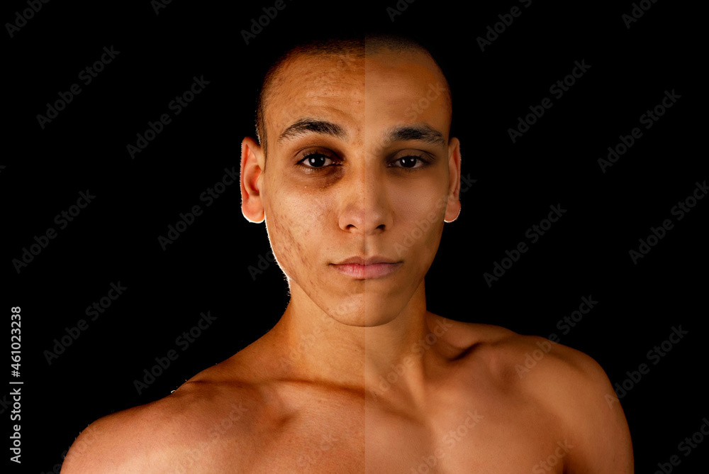 Fototapeta premium the concept of skin care before, after. young egytian man with bad skin with wrinkles and acne and after with perfect skin. comparison of the result on black background.
