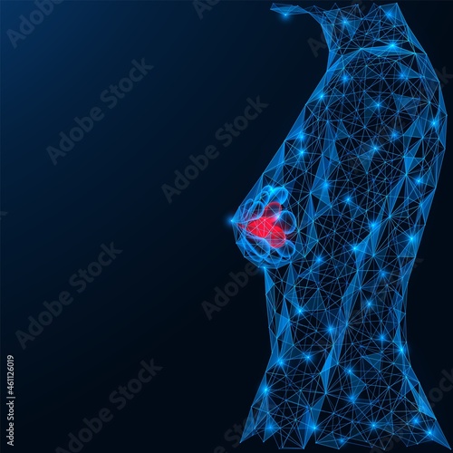Breast cancer. Female breasts with symptoms of the disease. A low-poly construction of interconnected lines and dots. Blue background.