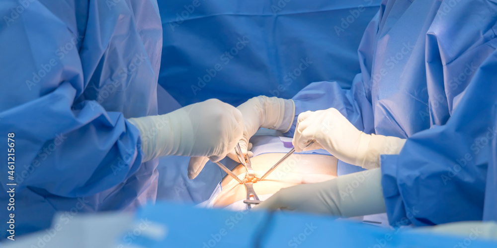A team of surgeons in hospital doing minimal invasive surgical interventions. Surgery in modern operating room with equipment for emergency surgery center.Medical concept. A team of surgeons in hospital doing minimal invasive surgical interventions. Surgery in modern operating room with equipment for emergency surgery center.Medical concept.