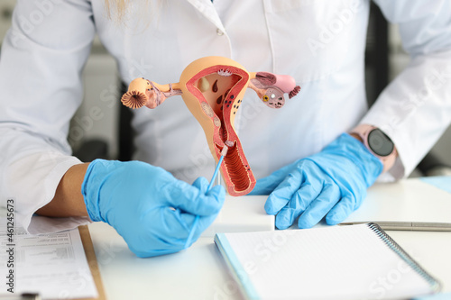 Gynecologist holds model of female reproductive system and cytological brush photo