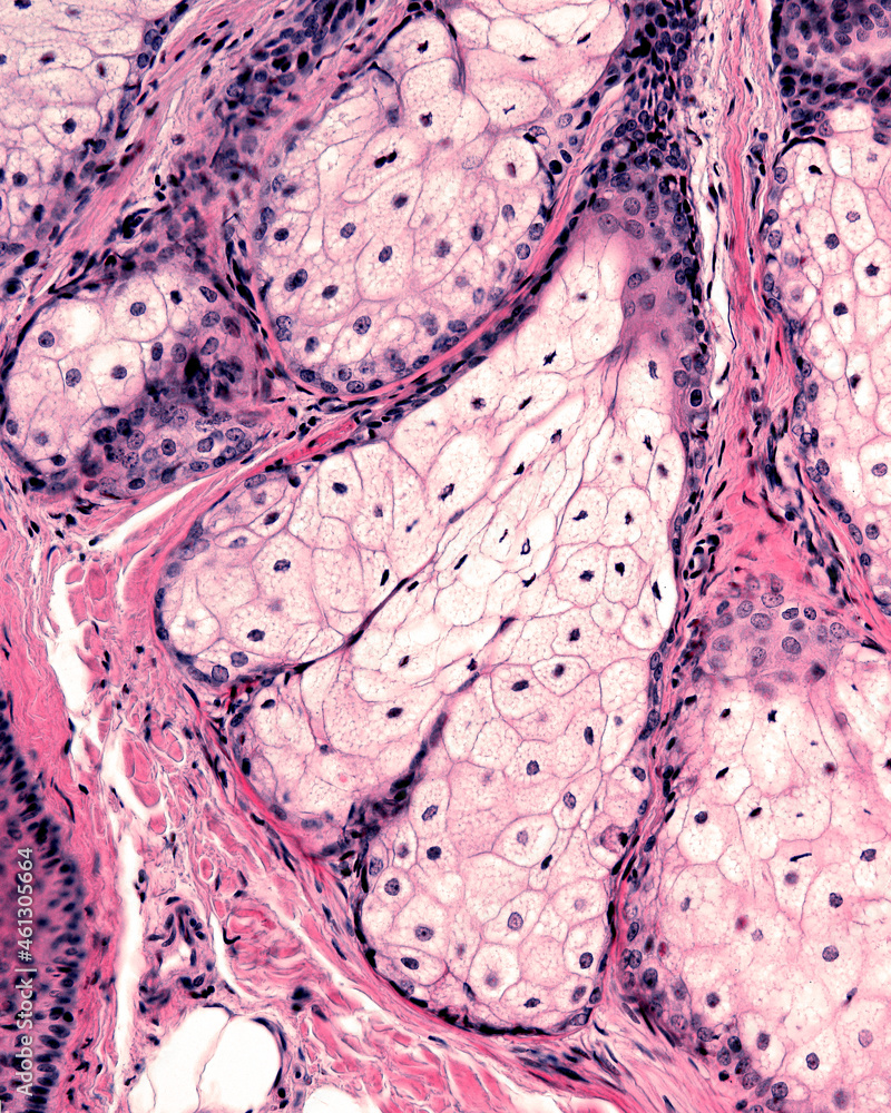Human skin. Sebaceous gland Stock Photo Biology Diagrams