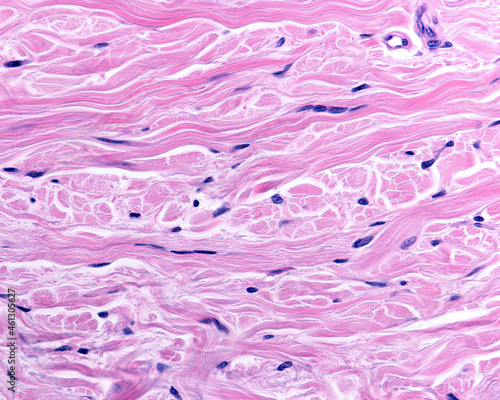 Reticular dermis. Human skin photo