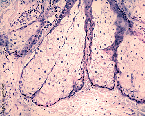 Human skin. Sebaceous gland photo