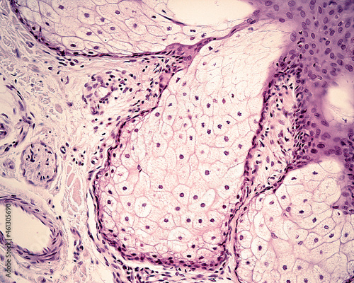 Human skin. Sebaceous gland