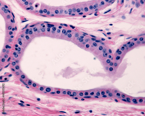 Apocrine sweat gland. Columnar epithelium photo