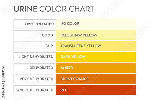 Urine color chart. Pee hydration and dehydration test strip. Vector design for medical education poster.