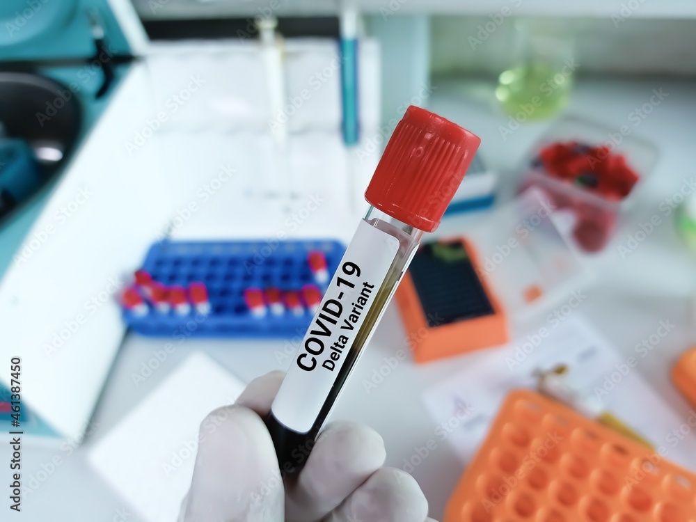 Biochemist holds test tube with blood sample for coronavirus infection. Covid 19 Delta Variant test tube in laboratory background.