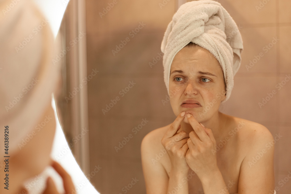 Sad unhappy young adult woman wearing bath towel squeezing acne on chin, mirror reflection of female with pimples on her face, skin problems, skin care. Sad unhappy young adult woman wearing bath towel squeezing acne on chin, mirror reflection of female with pimples on her face, skin problems, skin care.