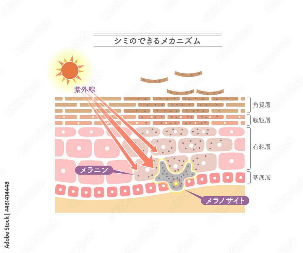 シミのできるメカニズムを示すイラスト 日本語表記 Stock Vector Adobe Stock